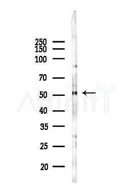 FLIP Antibody - Western blot analysis of lysates from Mouse liver, using FLIP Antibody at 1/1000 dilution.