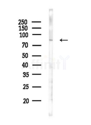 SLP76 Antibody - Western blot analysis of lysates from HepG2 cells(starvation,24h treatment), using SLP76 Antibody at 1/1000 dilution.
