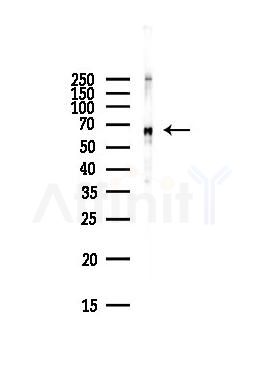 AIFM1 Antibody - Western blot analysis of lysates from Hela cells(starvation,24h treatment), using AIFM1 Antibody at 1/1000 dilution.