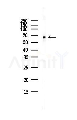 AIFM1 Antibody - Western blot analysis of lysates from HUVEC cells(starvation,24h treatment), using AIFM1 Antibody at 1/1000 dilution.