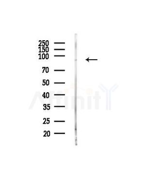 FES Antibody - Western blot analysis of lysates from PC12 cells(heat-shock, 45min treatment), using FES Antibody at 1/1000 dilution.