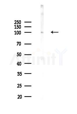 NRP2 Antibody - Western blot analysis of lysates from COLO205 cells(heat-shock,45min treatment), using NRP2 Antibody at 1/1000 dilution.