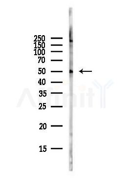 MEF2C Antibody - Western blot analysis of lysates from Hela cells(starvation,24h treatment), using MEF2C Antibody at 1/1000 dilution.