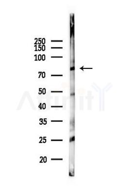 DRP1 Antibody - Western blot analysis of lysates from Mouse liver, using DRP1 Antibody at 1/1000 dilution.