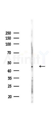 CNTFR Antibody - Western blot analysis of lysates from Hela cells(LPS,4h treatment), using CNTFR Antibody at 1/1000 dilution.