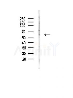 IL18R1 Antibody - Western blot analysis of lysates from HUVEC cells(LPS, 4h treatment), using IL18R1 Antibody at 1/1000 dilution.