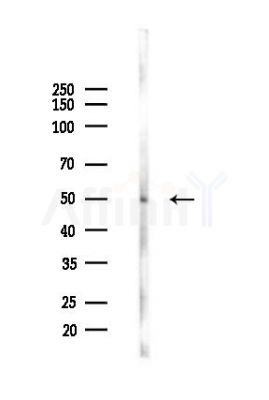 HSF2 Antibody - Western blot analysis of lysates from HepG2 cells(heat-shock,45min treatment), using HSF2 Antibody at 1/1000 dilution.