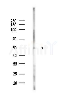 HSF2 Antibody - Western blot analysis of lysates from COLO205 cells(heat-shock,45min treatment), using HSF2 Antibody at 1/1000 dilution.