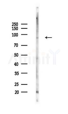 VCP Antibody - Western blot analysis of lysates from HepG2 cells(heat-shock,45min treatment), using VCP Antibody at 1/1000 dilution.