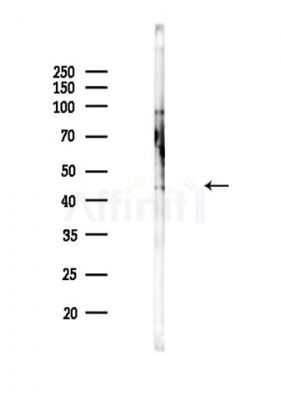 CXCR2 Antibody - Western blot analysis of lysates from EC304 cells(LPS,4h treatment), using CXCR2 Antibody at 1/1000 dilution.