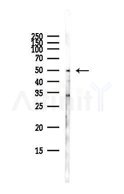 DRD1 Antibody - Western blot analysis of lysates from Hela cells(starvation,24h treatment), using DRD1 Antibody at 1/1000 dilution.