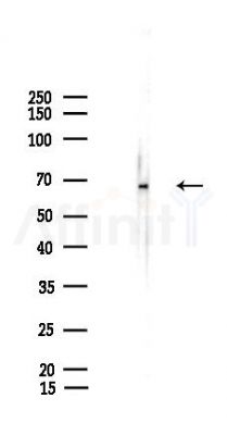 LAMP3 Antibody - Western blot analysis of lysates from HUVEC cells(UV,30min treatment), using LAMP3 Antibody at 1/1000 dilution.