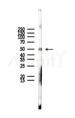 EDA Antibody - Western blot analysis of lysates from Rat liver, using EDA Antibody at 1/1000 dilution.