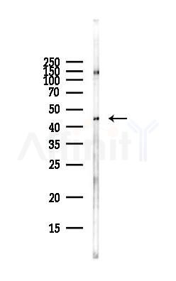 CXCR3 Antibody - Western blot analysis of lysates from HepG2 cells(heat-shock,45min treatment), using CXCR3 Antibody at 1/1000 dilution.