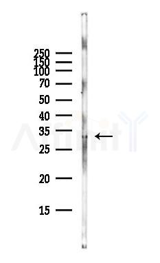 GJB3 Antibody - Western blot analysis of lysates from Hela cells(starvation,24h treatment), using GJB3 Antibody at 1/1000 dilution.