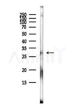 GJB3 Antibody - Western blot analysis of lysates from HepG2 cells(heat-shock,45min treatment), using GJB3 Antibody at 1/1000 dilution.