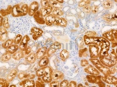 Gelsolin Antibody - DF7117 at 1/100 staining human normal kidney tissue by IHC-P.