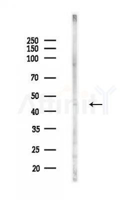 KISS1R Antibody - Western blot analysis of lysates from COLO205 cells(heat-shock,45min treatment), using KISS1R Antibody at 1/1000 dilution.