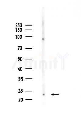 HMGB2 Antibody - Western blot analysis of lysates from HepG2 cells(heat-shock,45min treatment), using HMGB2 Antibody at 1/1000 dilution.