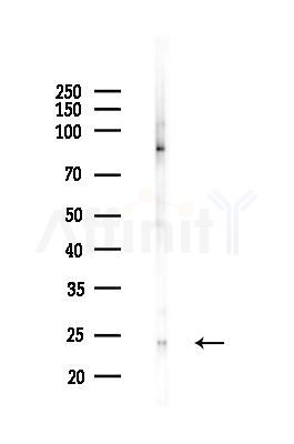 HMGB2 Antibody - Western blot analysis of lysates from COLO205 cells(heat-shock,45min treatment), using HMGB2 Antibody at 1/1000 dilution.