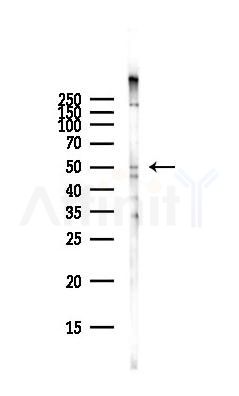 SLC16A1 Antibody - Western blot analysis of lysates from Hela cells(starvation,24h treatment), using SLC16A1 Antibody at 1/1000 dilution.