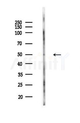 SLC16A4 Antibody - Western blot analysis of lysates from HUVEC cells(LPS,4h treatment), using SLC16A4 Antibody at 1/1000 dilution.