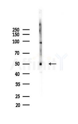 MMP10 Antibody - Western blot analysis of lysates from HepG2 cells(heat-shock,45min treatment), using MMP10 Antibody at 1/1000 dilution.