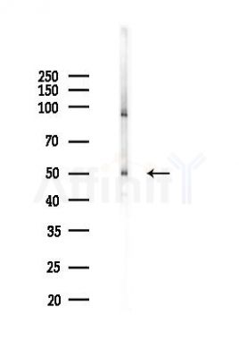 MMP10 Antibody - Western blot analysis of lysates from COLO205 cells(heat-shock,45min treatment), using MMP10 Antibody at 1/1000 dilution.