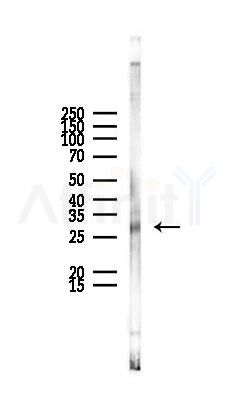POMC Antibody - Western blot analysis of lysates from Rat liver, using POMC Antibody at 1/1000 dilution.