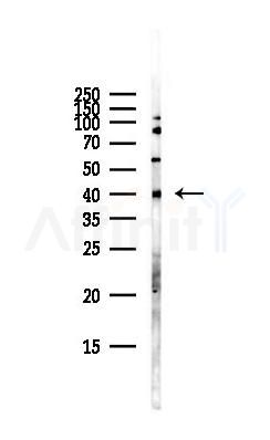 PAR4 Antibody - Western blot analysis of lysates from Hela cells(starvation,24h treatment), using PAR4 Antibody at 1/1000 dilution.