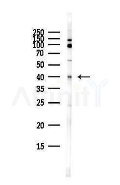 PAR4 Antibody - Western blot analysis of lysates from HepG2 cells(heat-shock,45min treatment), using PAR4 Antibody at 1/1000 dilution.