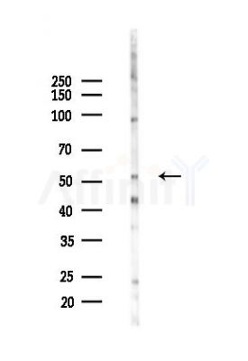 SLC1A4 Antibody - Western blot analysis of lysates from HepG2 cells(heat-shock,45min treatment), using SLC1A4 Antibody at 1/1000 dilution.