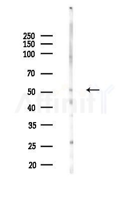 SLC1A4 Antibody - Western blot analysis of lysates from COLO205 cells(heat-shock,45min treatment), using SLC1A4 Antibody at 1/1000 dilution.