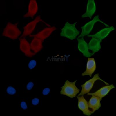 NPY1R Antibody - DF7194 staining Hela cells(45min of heat-shock) by IF/ICC.