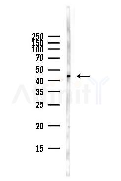 NSE Antibody - Western blot analysis of lysates from Hela cells(starvation,24h treatment), using NSE Antibody at 1/1000 dilution.