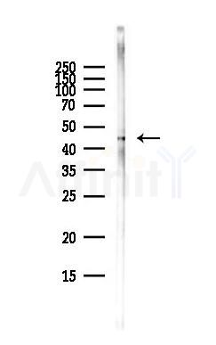 NSE Antibody - Western blot analysis of lysates from HepG2 cells(heat-shock,45min treatment), using NSE Antibody at 1/1000 dilution.