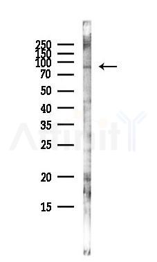 PARP1 Antibody - Western blot analysis of lysates from HepG2 cells(heat-shock,45min treatment), using PARP1 Antibody at 1/1000 dilution.