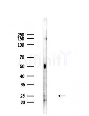 SFTPA1 Antibody - Western blot analysis of lysates from Hela cells(heat-shock,45min treatment), using SFTPA1 Antibody at 1/1000 dilution.