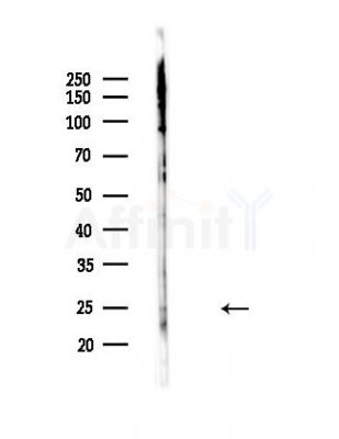SFTPA1 Antibody - Western blot analysis of lysates from Mouse lung, using SFTPA1 Antibody at 1/1000 dilution.