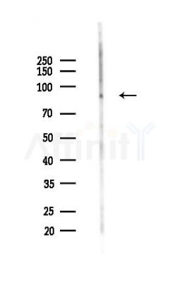 CUL3 Antibody - Western blot analysis of lysates from HepG2 cells(heat-shock,45min treatment), using CUL3 Antibody at 1/1000 dilution.