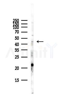 GSK3 beta Antibody - Western blot analysis of lysates from Hela cells(starvation,24h treatment), using GSK3 beta Antibody at 1/1000 dilution.