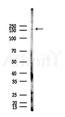 MSH6 Antibody - Western blot analysis of lysates from B16F10-LUC cells(starvation,24h treatment), using MSH6 Antibody at 1/1000 dilution.