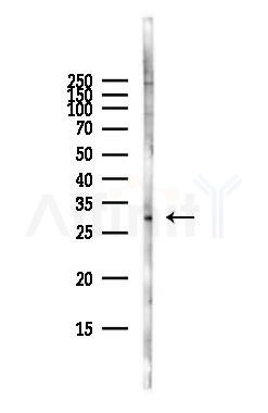 ERCC1 Antibody - Western blot analysis of lysates from Hela cells(starvation,24h treatment), using ERCC1 Antibody at 1/1000 dilution.