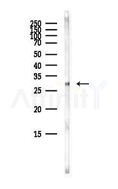 ERCC1 Antibody - Western blot analysis of lysates from Mouse brain, using ERCC1 Antibody at 1/1000 dilution.