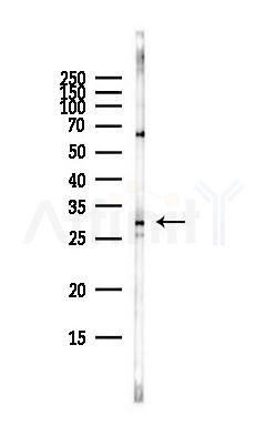 ERCC1 Antibody - Western blot analysis of lysates from HepG2 cells(heat-shock,45min treatment), using ERCC1 Antibody at 1/1000 dilution.