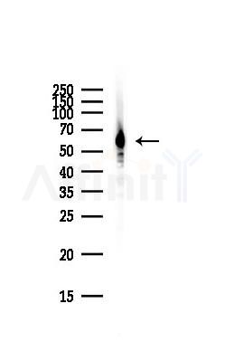 DDX5 Antibody - Western blot analysis of lysates from Hela cells(starvation,24h treatment), using DDX5 Antibody at 1/1000 dilution.