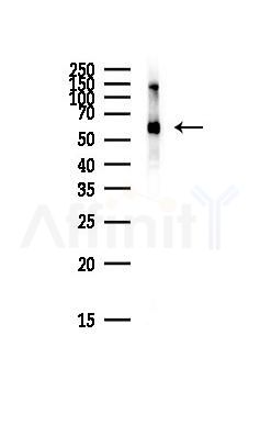 DDX5 Antibody - Western blot analysis of lysates from Mouse brain, using DDX5 Antibody at 1/1000 dilution.