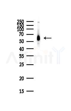 DDX5 Antibody - Western blot analysis of lysates from HepG2 cells(heat-shock,45min treatment), using DDX5 Antibody at 1/1000 dilution.