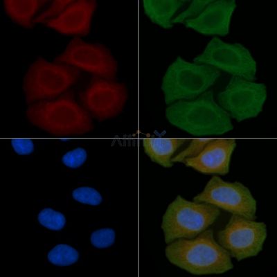C1QB Antibody - DF7283 staining Hela cells(45min of heat-shock) by IF/ICC.