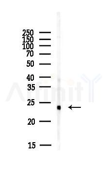 EFNA1 Antibody - Western blot analysis of lysates from PC12 cells(LPS,4h treatment), using EFNA1 Antibody at 1/1000 dilution.